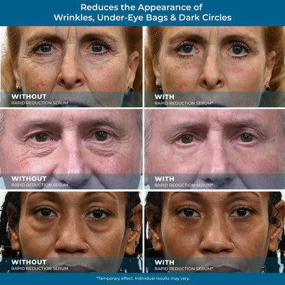 ZeroBags™ Under-Eye Serum