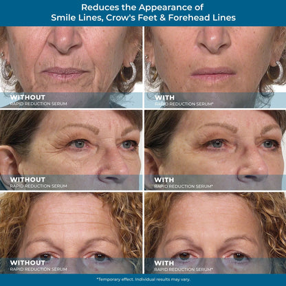 ZeroBags™ Under-Eye Serum